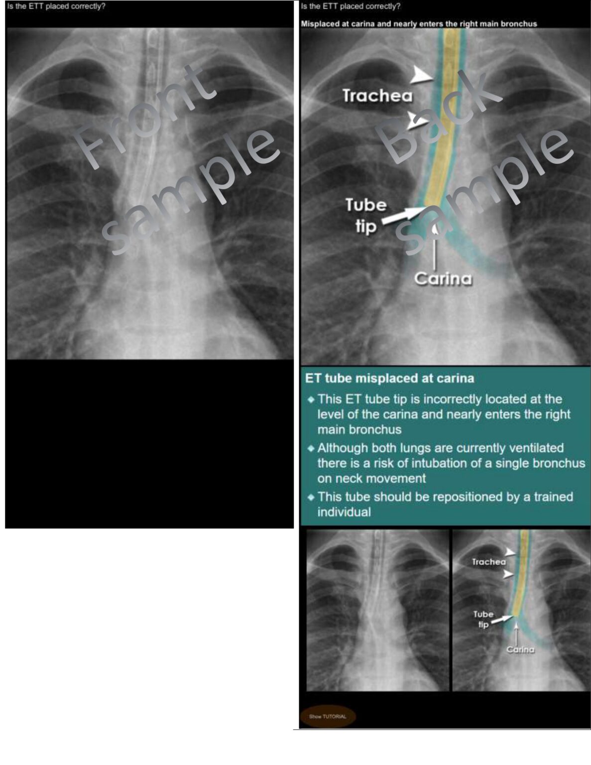 4 Best Radiology Anki Decks Learn Radiology Fast (2021) willpeachMD