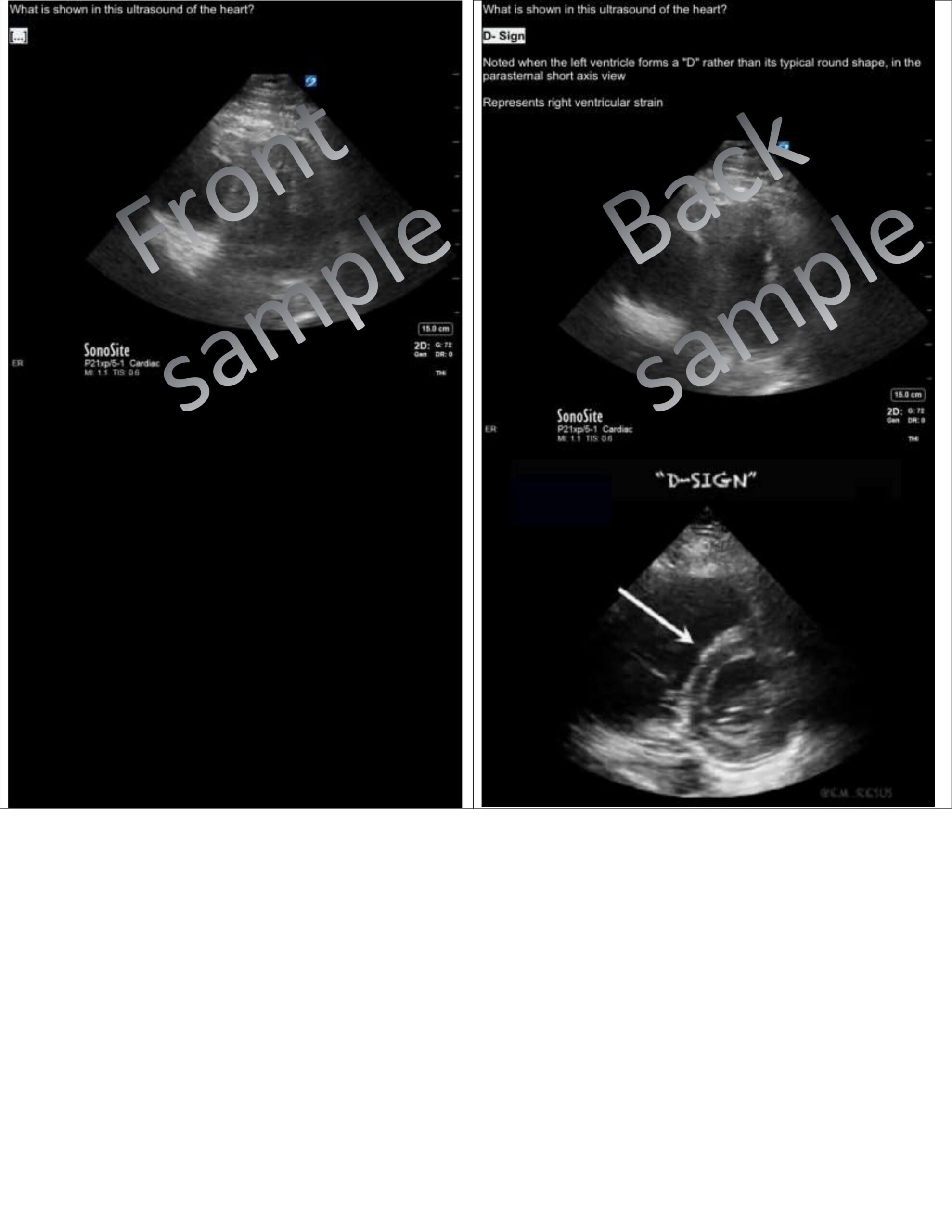 4 Best Radiology Anki Decks Learn Radiology Fast (2021) willpeachMD