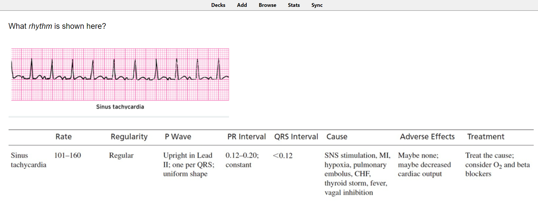 3 Best EKG Anki Decks Learn EKG Fast (2021) willpeachMD